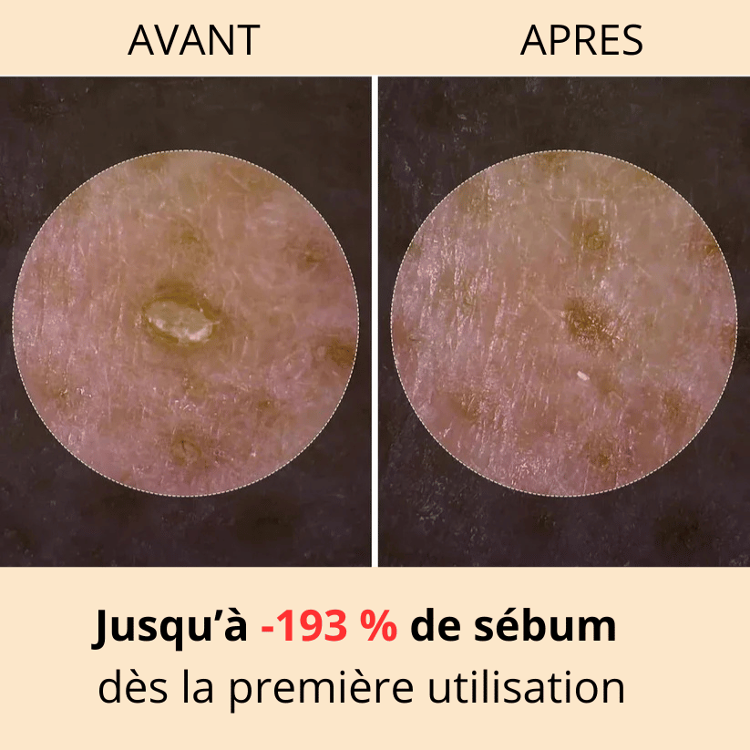 Ampoule de sérum éclat au peeling de riz